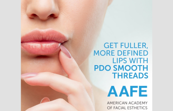 Get Fuller, More Defined Lips With PDO Smooth Threads AAFE