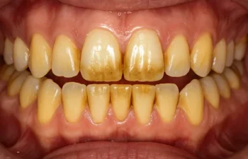 how can coffee affect smile